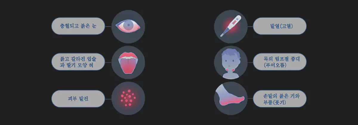 가와사키병-kawasaki-disease